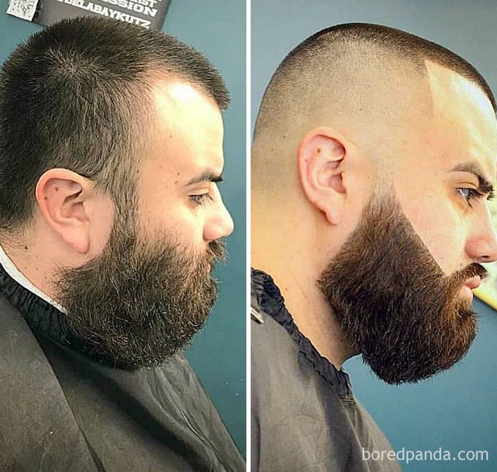 before after beard transformations 47 5c41c66e85859 700