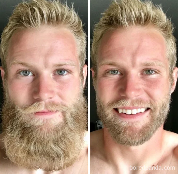 before after beard transformations 5 5c3f075917872 700