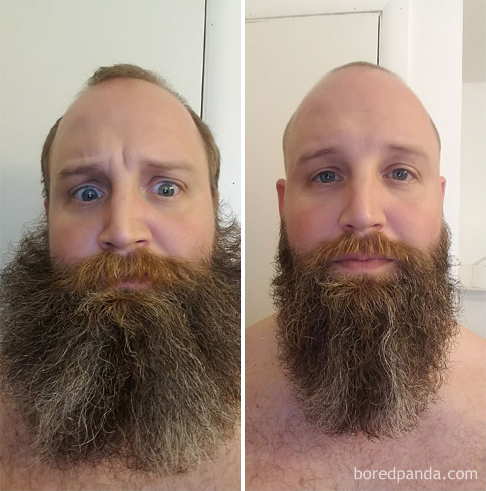 before after beard transformations 60 5c4097877260b 700