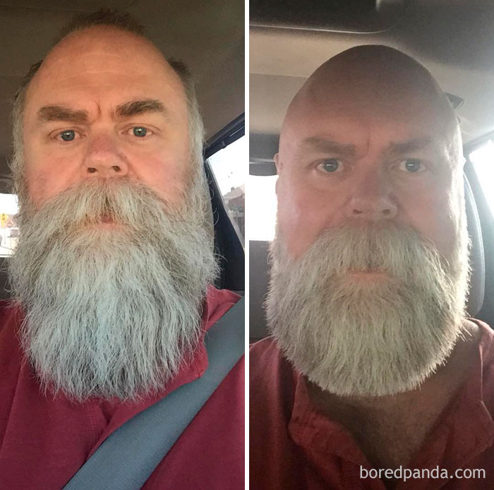 before after beard transformations 77 5c41873e52bc4 700