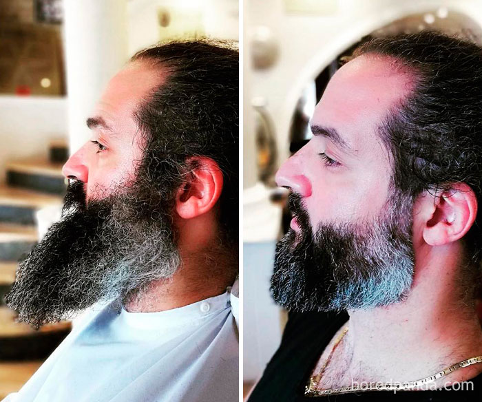before after beard transformations 84 5c418ebe67ecb 700