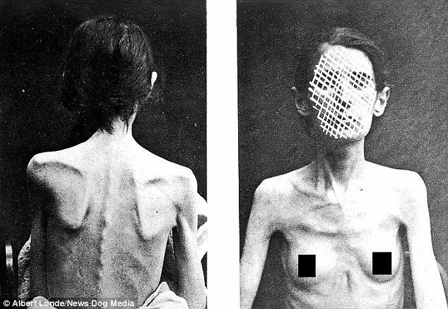 little is known about the vulnerable women pictured but they would have been hospitalised for conditions such as hysteria and what is now known as anorexia nervosa