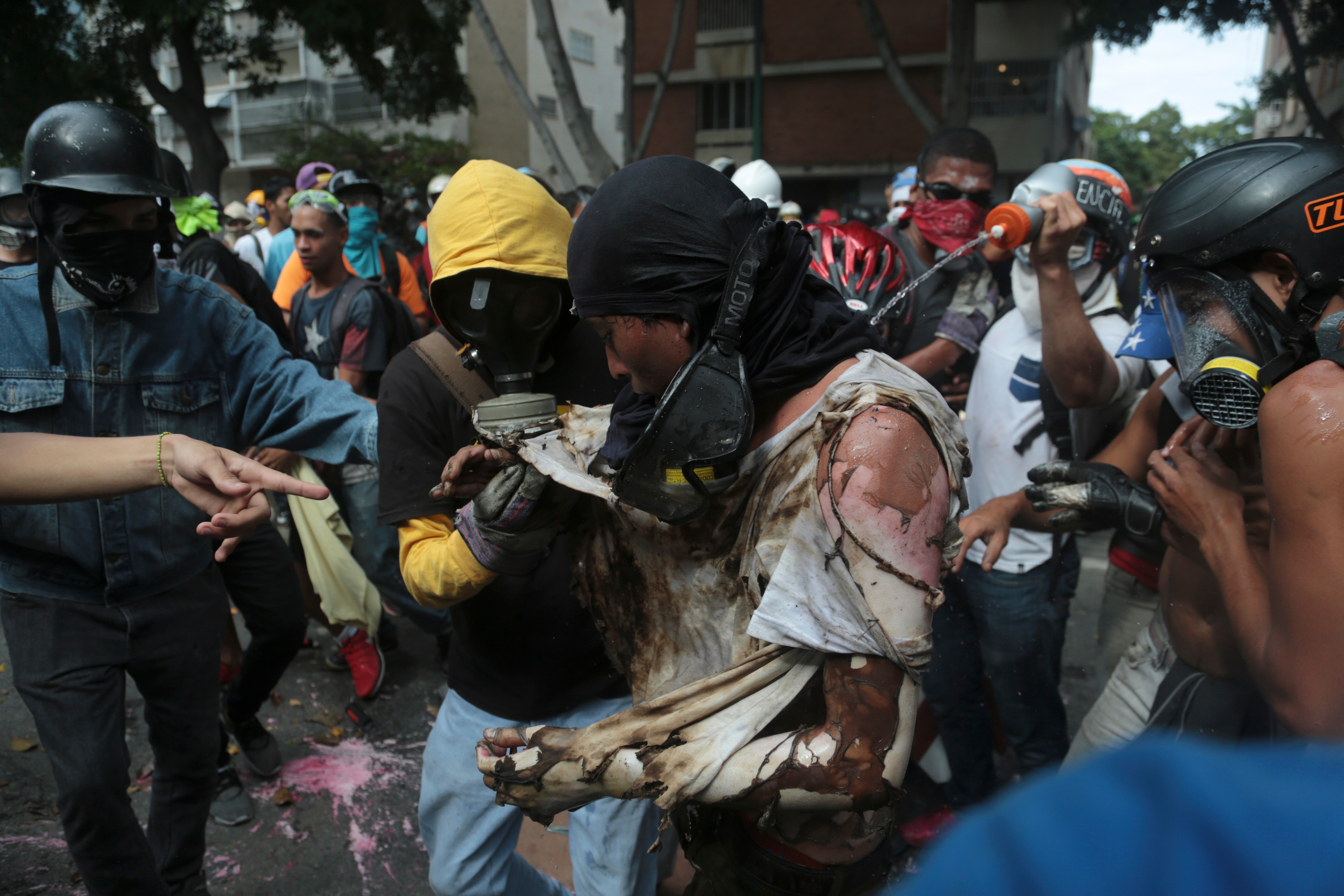 Những người tham gia biểu tình kịp thời trợ giúp José Víctor Salazar Balza trước khi anh bị phỏng quá nặng. Ảnh: Fernando Llano/AP.