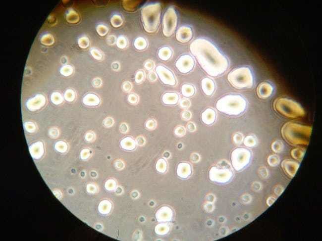 astronauts accidentally made super bacteria photo u1 w650q50fmjpgfitcropcropfaces