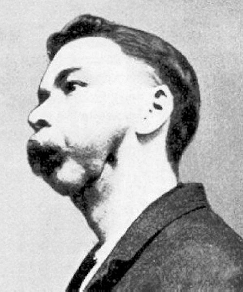 498px match factory worker with phossy jaw