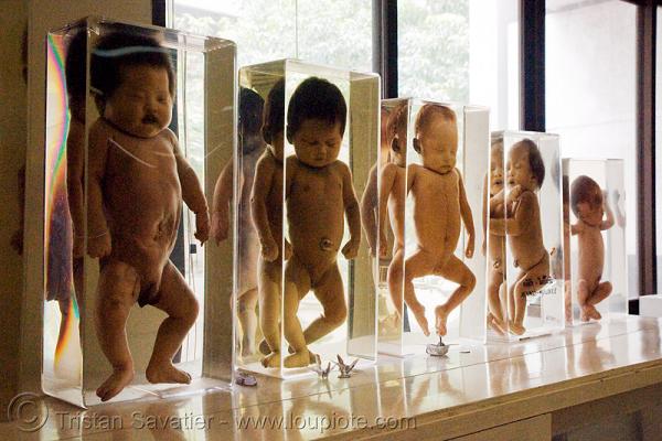 2632835157 dead babies preserved forensic medicine museum siriraj hospital bangkok thailand