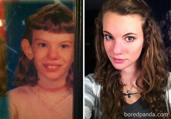 before after ugly duckling beauty transformation 6