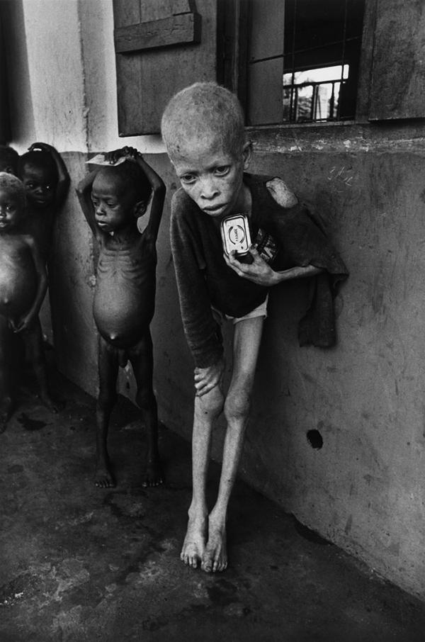 time 100 influential photos don mccullin albino boy biafra 63