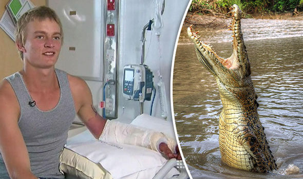 crocodile attack australia teenager date 781848