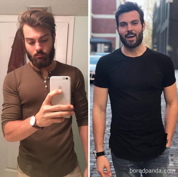 before after beard transformations 12 5c3f25f64ca07 700