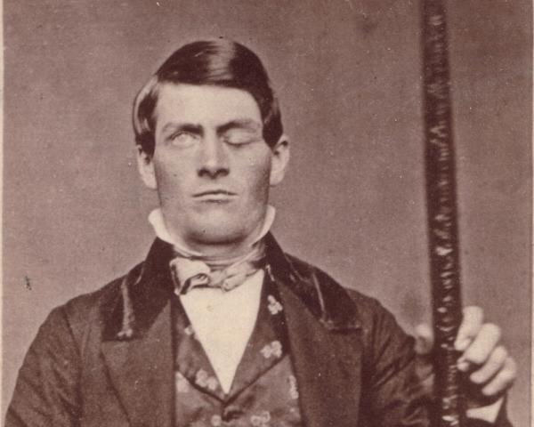 phineas gage 3