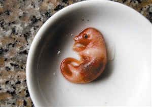 6684pangolin fetus
