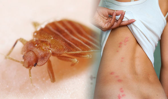 bed bug bites three signs you ve been bitten and how to get rid of an infestation 1023285